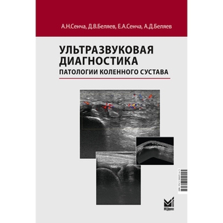 Ультразвуковая диагностика патологии коленного сустава Сенча А.Н., Беляев Д.В., Сенча Е.А., Беляев А.Д. 2026 г. (МЕДпресс)