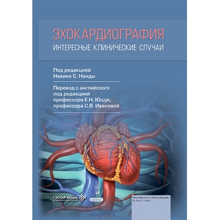 Эхокардиография. Интересные клинические случаи. под ред. Н. С. Нанды 2026 г. (Гэотар) Эхокардиография. Интересные клинические случаи. под ред. Н. С. Нанды 2026 г. (Гэотар)