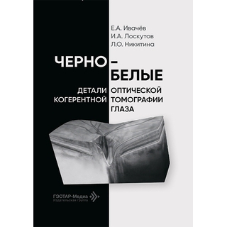 Черно-белые детали оптической когерентной томографии глаза / Е. А. Ивачёв, И. А. Лоскутов, Л. О. Никитина 2026 г. (Гэотар) Черно-белые детали оптической когерентной томографии глаза / Е. А. Ивачёв, И. А. Лоскутов, Л. О. Никитина 2026 г. (Гэотар)